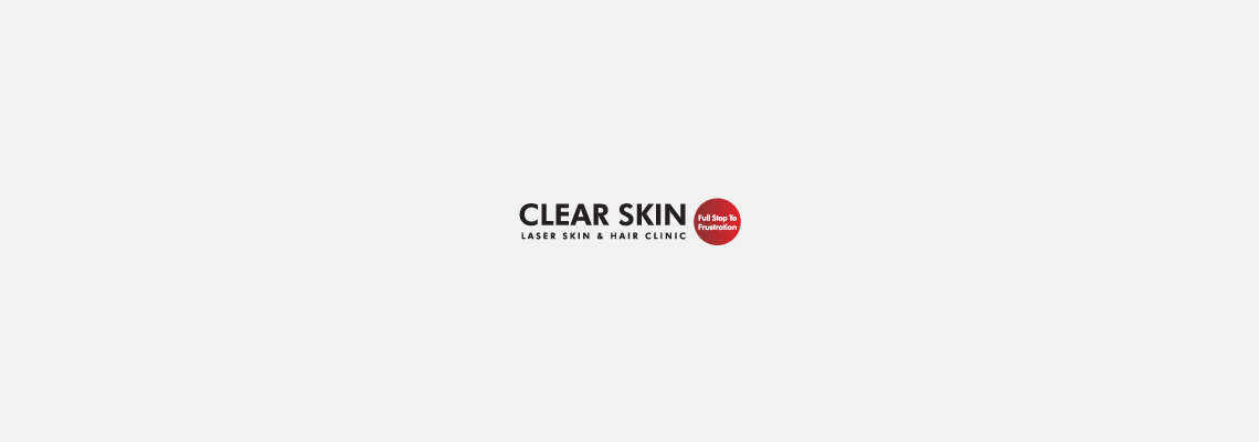 20-Clear-Skin_Banner